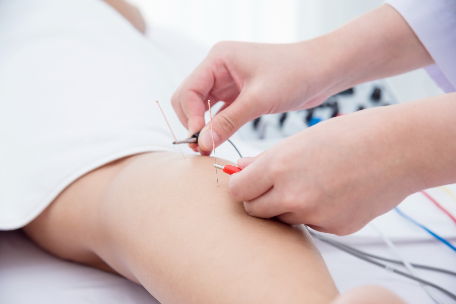 Acupunture wirral.jpeg